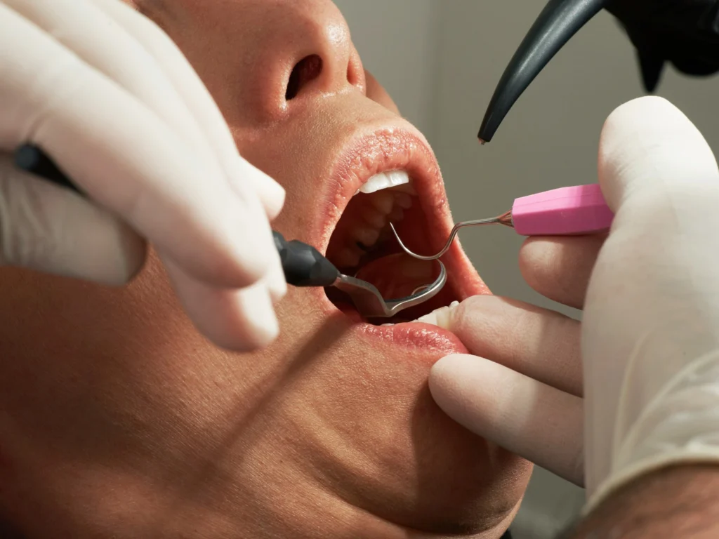 withdrawing super for dental treatment